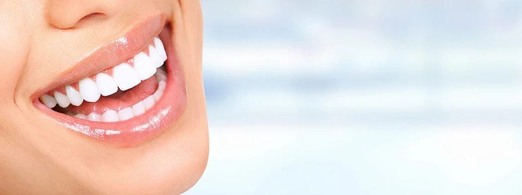 What are dental veneers ? 3